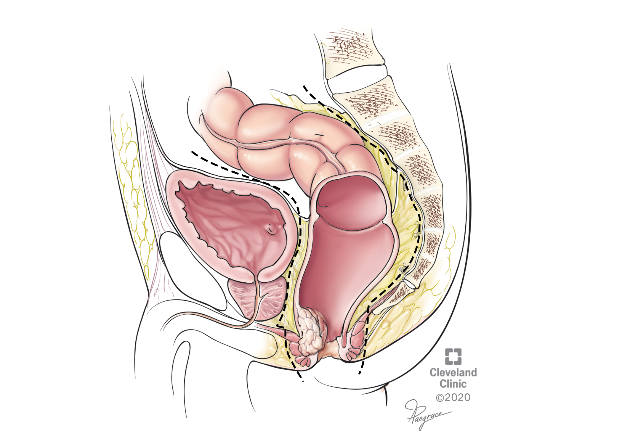 Descriptive text is not available for this image