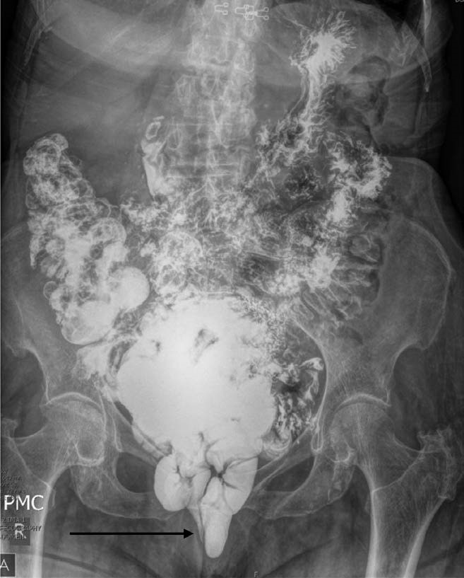 Descriptive text is not available for this image