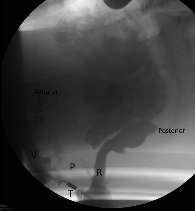 Descriptive text is not available for this image