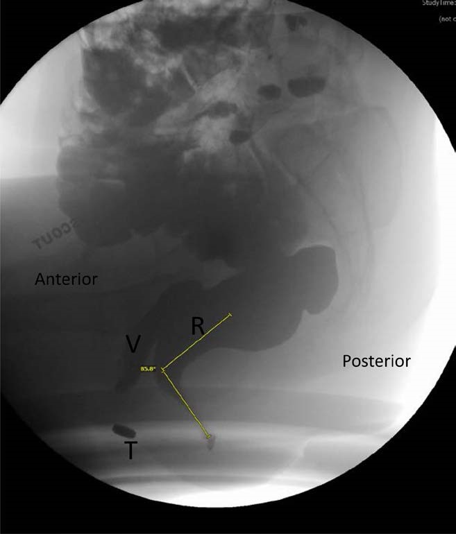 Descriptive text is not available for this image